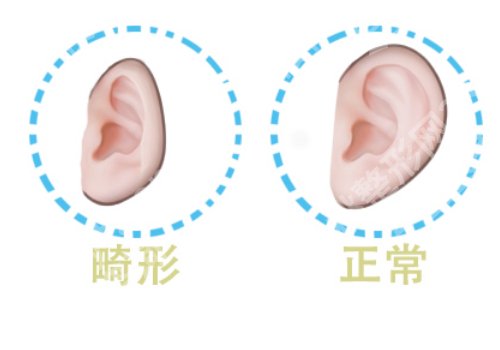 段伟强耳再造有名吗?医生优势介绍及案例分享