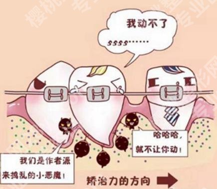 北京大学口腔医院正畸费用是多少？正畸费用大概需要4000元起