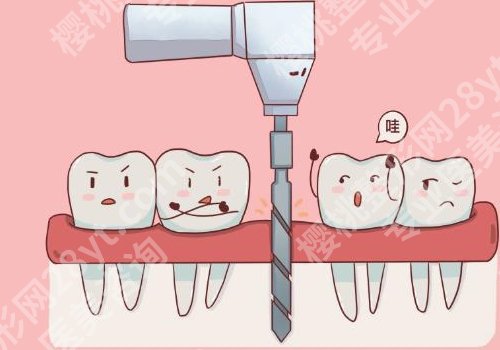 武汉大学口腔医院种植牙哪个医生好？李蓉、白轶实力都不错