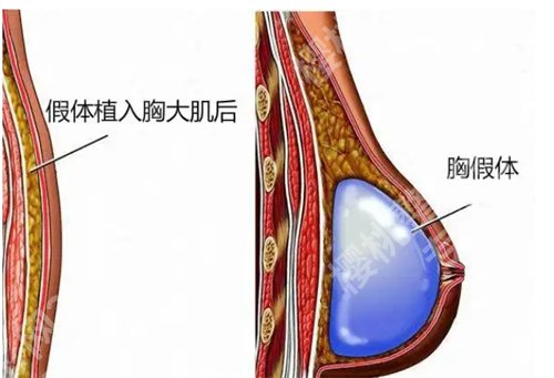 荔湾区人民医院隆胸怎么样？一键查看医院信息