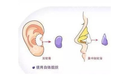 南方医科大学南方医院双眼皮手术哪个医生比较好？医院+医生基本信息