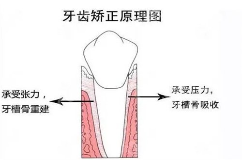 广州圣贝口腔牙齿矫正多少钱？项目具体介绍了