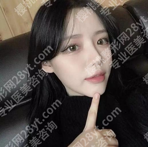 乌丹旦医生的唇裂手术怎么样？了解专家简介与相关案例分享