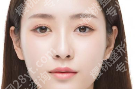 乌丹旦医生的唇裂手术怎么样？了解专家简介与相关案例分享