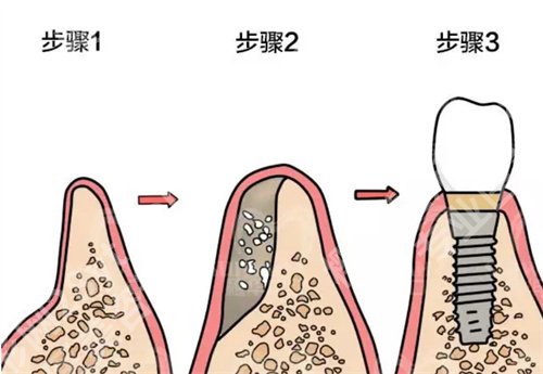 清远人民医院种牙套价格？一键查看医院简介