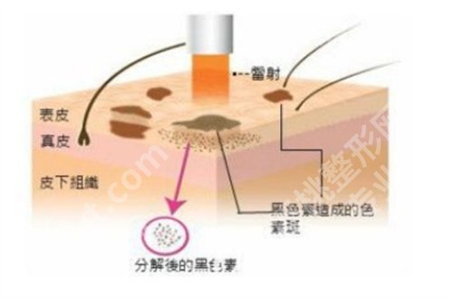深圳医院做点阵激光多少钱？医院简介，详情一览