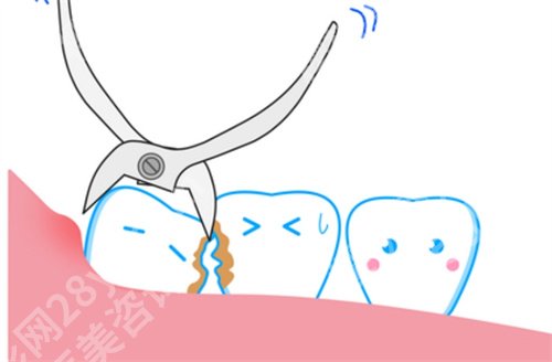 深圳北大医院拔牙齿多少钱？面诊攻略