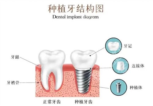 北京煤炭总医院牙科怎么样？主打项目收费介绍