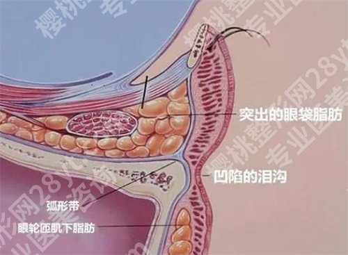 长海医院去眼袋手术好吗？特色项目公布