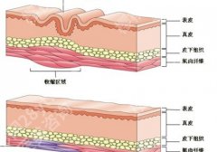 上海华山医院光子嫩肤多少钱？医院基本介绍