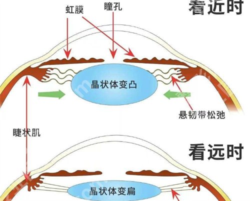 中山人民医院激光近视手术多少钱？医院亮点