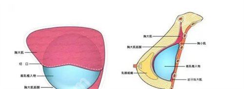 上海第九医院隆胸哪位医生好点?项目推荐来袭