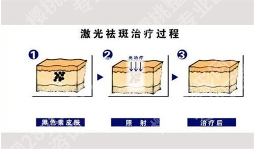 广州医科大学附属第一医院激光科袪斑怎么样？顾客点评