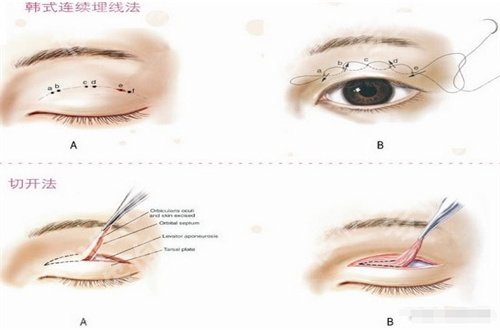 杨运华医生个人简历公布，面诊细节+价目表展示