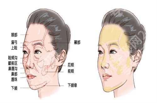 顾建成医生填充脸部怎么样？附真人案例反馈