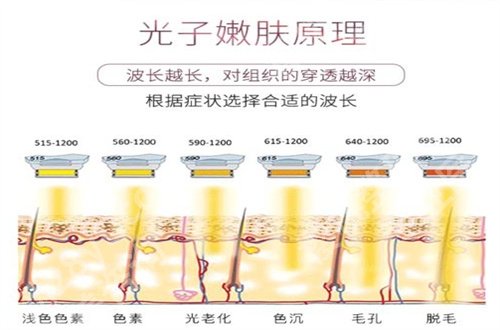 丁远光光子嫩肤怎么样？详细介绍、口碑点评通通整理