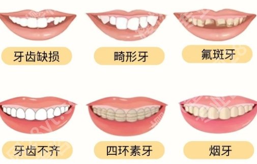 珠海市第二人民医院种植牙价格是的多少？全新价格出炉