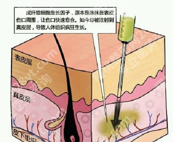 北京韩岩取生长因子怎么样？医院面诊小技巧get！