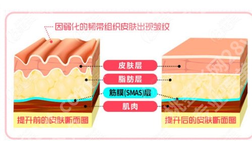 上海倪锋医生拉皮怎样？真实案例反馈