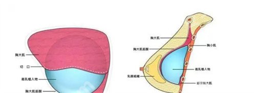 袁玉坤医生做自体脂肪丰胸价格公布！看真实口碑点评