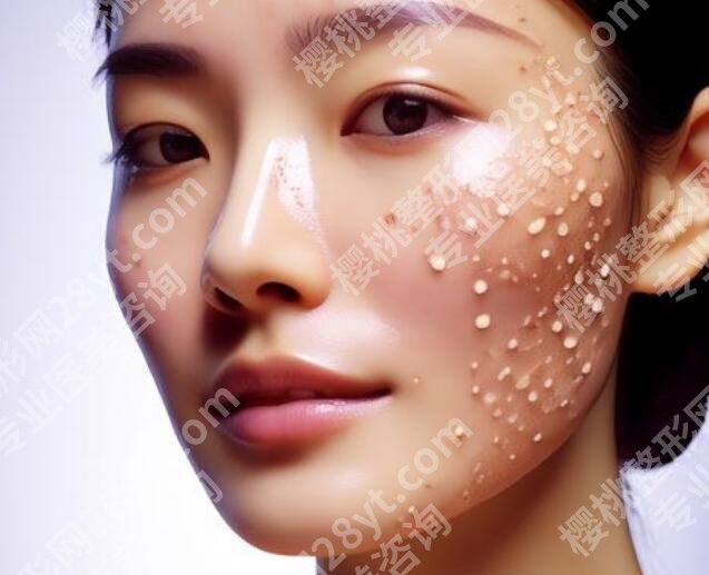 东莞环球美天整形医院口碑怎么样？真人祛斑案例展示！