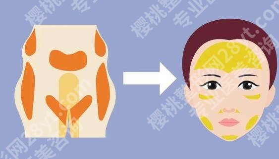 上海玻尿酸填充加瘦脸大概多少钱？效果可以维持多长时间？