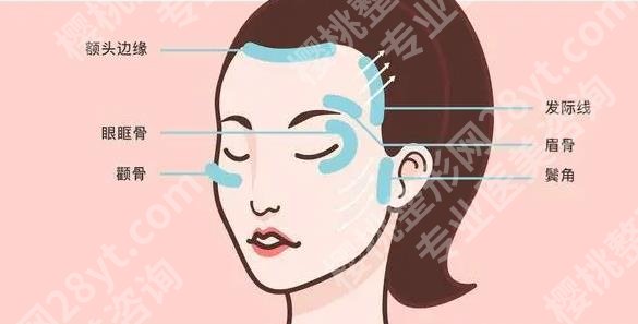 上海玻尿酸填充加瘦脸大概多少钱？效果可以维持多长时间？