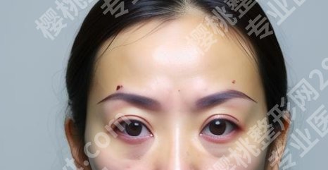 湘雅医院整形外科怎么样？戳进来看真实的案例鉴赏吧！