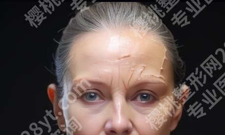 苏州康美美容医院玻尿酸怎么样？注射除皱的效果好吗？
