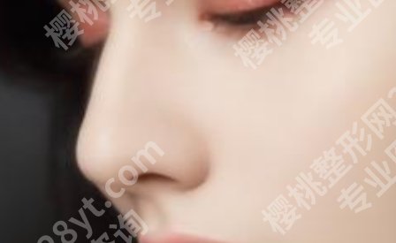 达川区人民医院整形美容外科医生哪位技术好？王量、王俊奇、杨跃等医生信息在线了解！