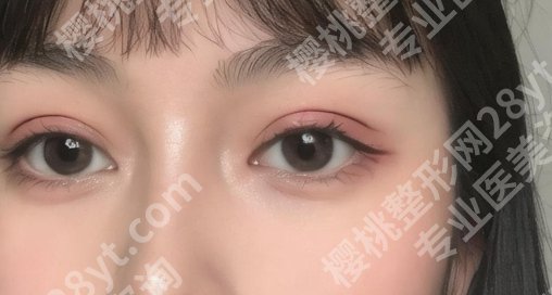 西京医院整形科李扬医生擅长的项目有哪些?面诊技巧get!