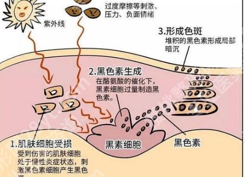 上海长征医院激光祛斑怎么样？人气医生介绍