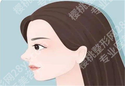 上海华山医院做鼻子好吗？详细面诊攻略+必问问题