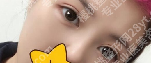 宁波市第六医院整形科哪个医生好？胡瑞斌、周丹亚、杨娴娴等技术可靠！