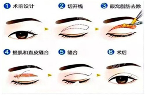 罗旭松口碑怎么样？医生实力曝光