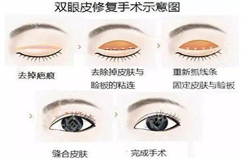 罗旭松口碑怎么样？医生实力曝光