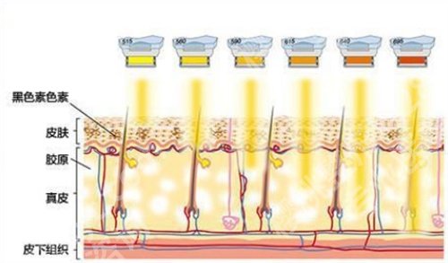 北大深圳医院光子嫩肤怎么样？主打项目，一文探索