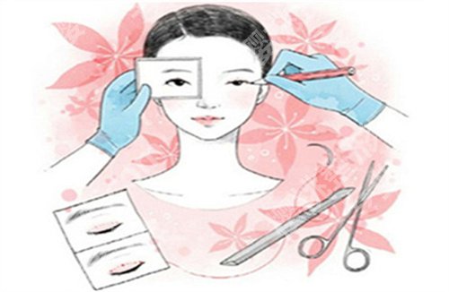 上海徐晓斐医生怎么样？医生技术点评