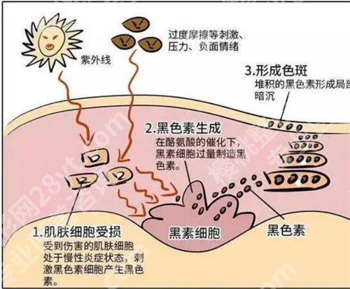 深圳人民医院激光祛斑多少钱一次?基本信息一览