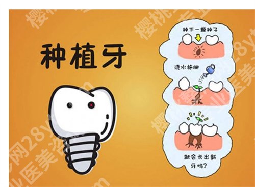 北京大学人民医院种植牙价格是多少？2025价格表查询