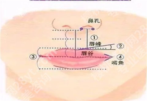 上海卢九宁做M唇怎么样？分享一份案例参考大全
