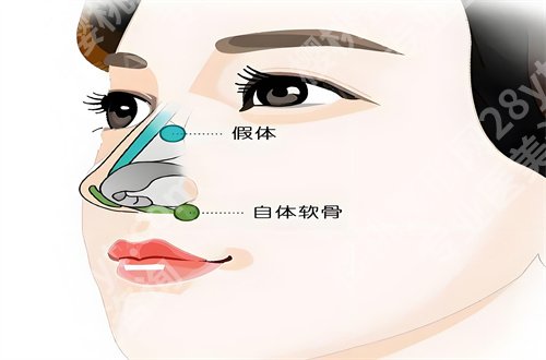 魏皎医生案例分享，一览专家医生的基本信息