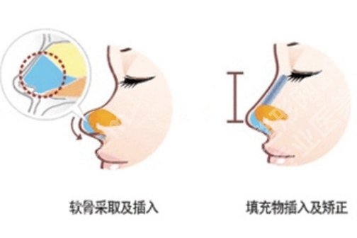 常州一院可以割双眼皮吗？科室简介公布