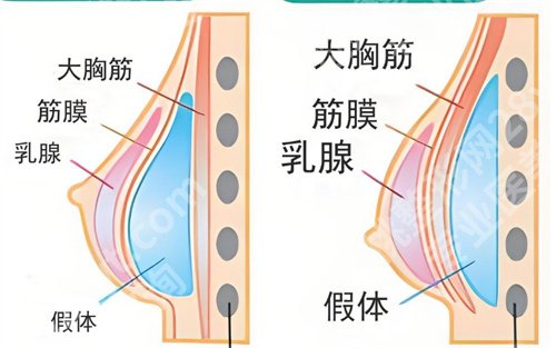 亓发芝隆胸怎么样？个人简介内容公布