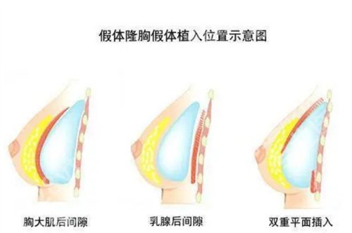 亓发芝隆胸怎么样？个人简介内容公布