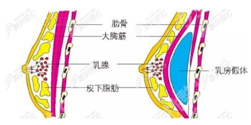 亓发芝隆胸怎么样？个人简介内容公布