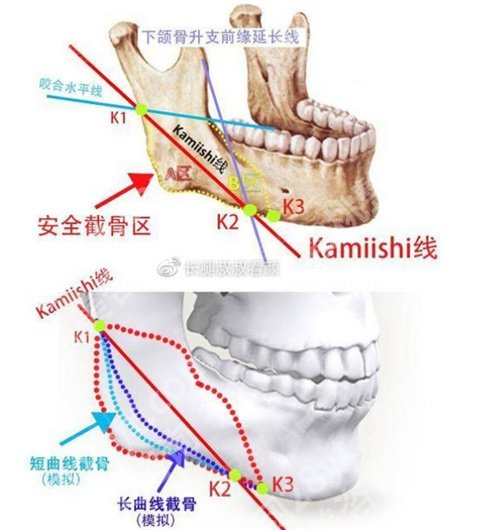 代杰文正颌怎么样？在线点评技术