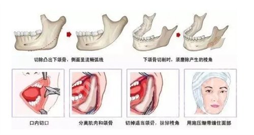 穆雄铮会亲自做手术吗？看技术点评