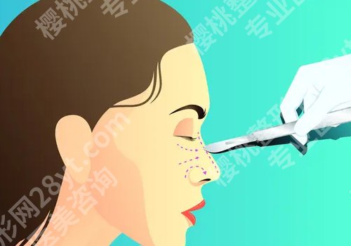 魏皎做鼻子怎么样？基本信息、体验感反馈、案例更新！