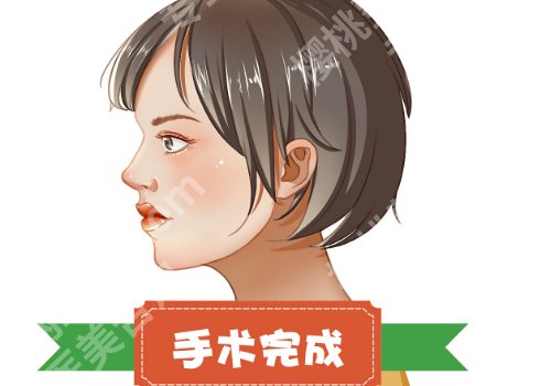 范荣杰做鼻子好吗？网友反馈、擅长项目、面诊小技巧